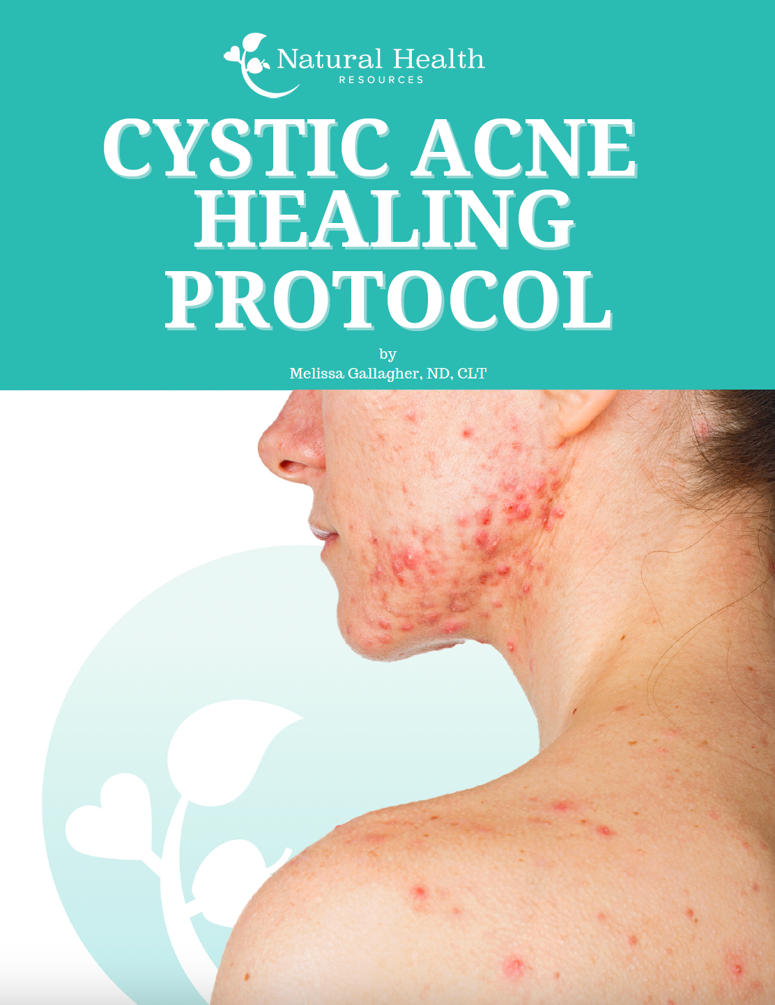 Acne Healing Protocol